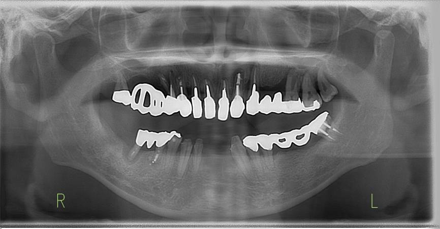 ���� ���܂܂�Ă���摜

�����I�ɐ������ꂽ����