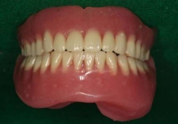 http://aoki-dentaloffice-kochi.com/endodontics.files/image282.jpg