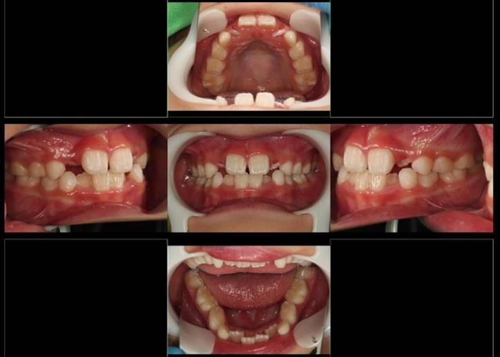 食品, 写真, 異なる, ケーキ が含まれている画像

自動的に生成された説明