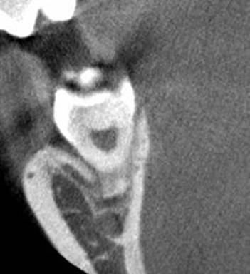 猫の顔の白黒写真

AI によって生成されたコンテンツは間違っている可能性があります。