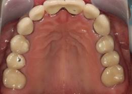 皿に盛られたクッキー

中程度の精度で自動的に生成された説明